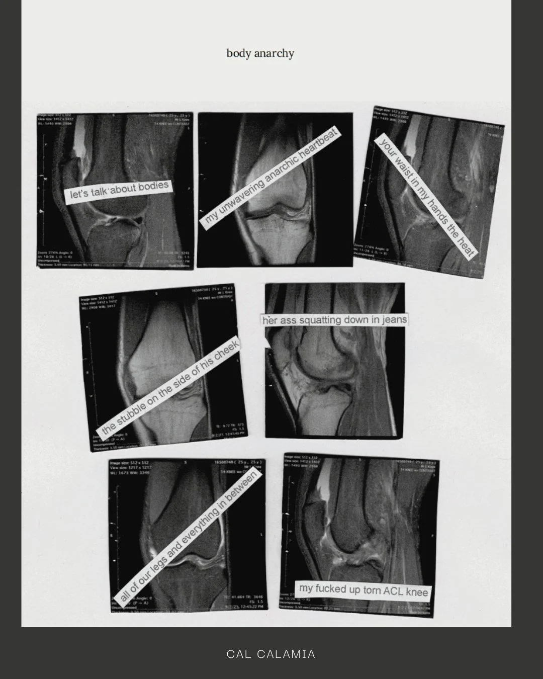 Online Exclusive Issue 1.1 | BODY POLITICS | 🔗 Check out the full issue at the link in our bio. 

Slide 1 - Visual Art, "Body Anarchy"
[image description: text on seven x-rays of kneecaps.]
Cal Calamia (they/he) is a trans poet, professor,