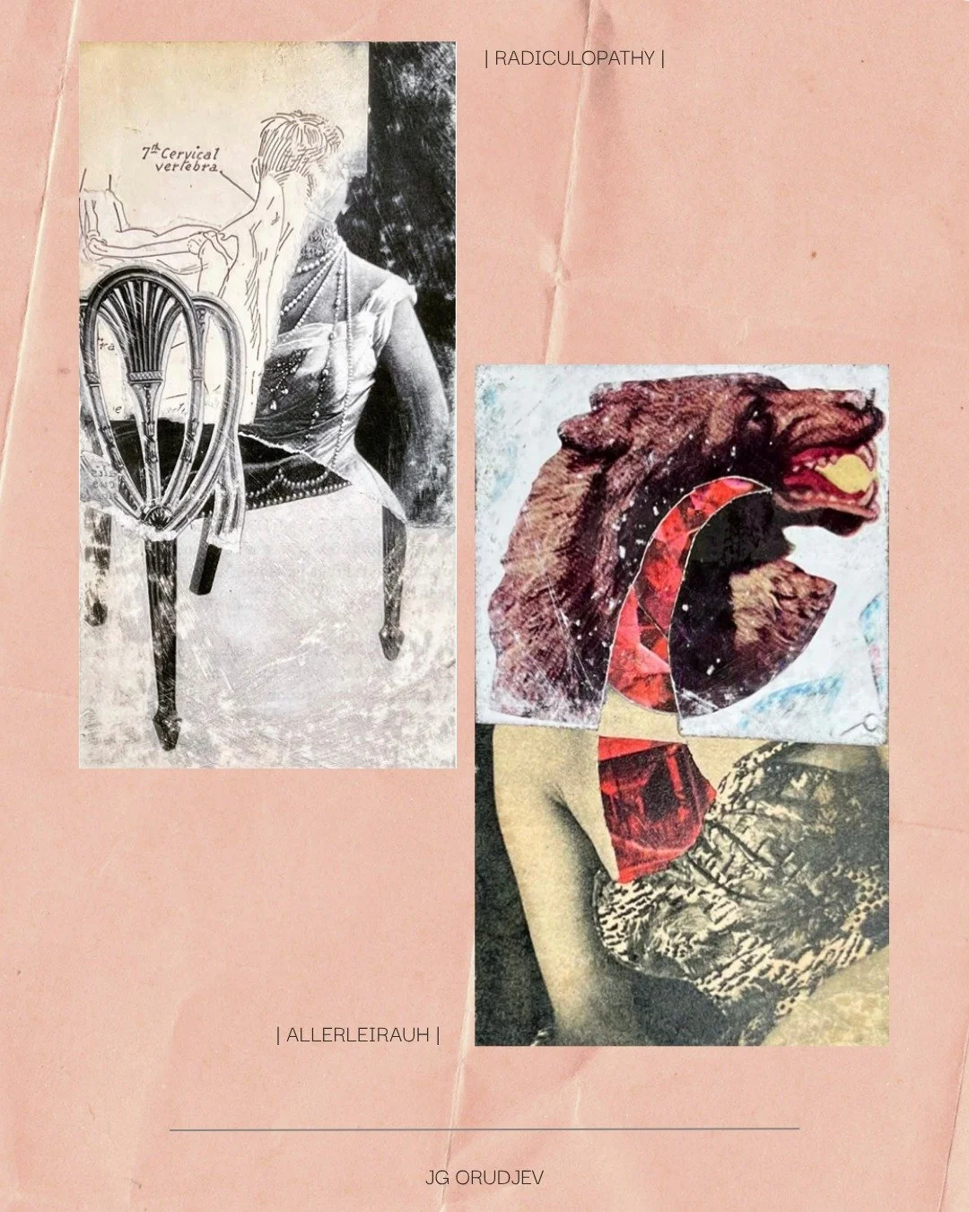 Online Exclusive Issue 1.1 | BODY POLITICS | 🔗 Check out the full issue at the link in our bio.

Slide 1: JG Orudjev | Radiculopathy | Allerleirauh 
J G Orudjev (she/her) is a mixed media artist, collagist, and sculptor living and working outside of