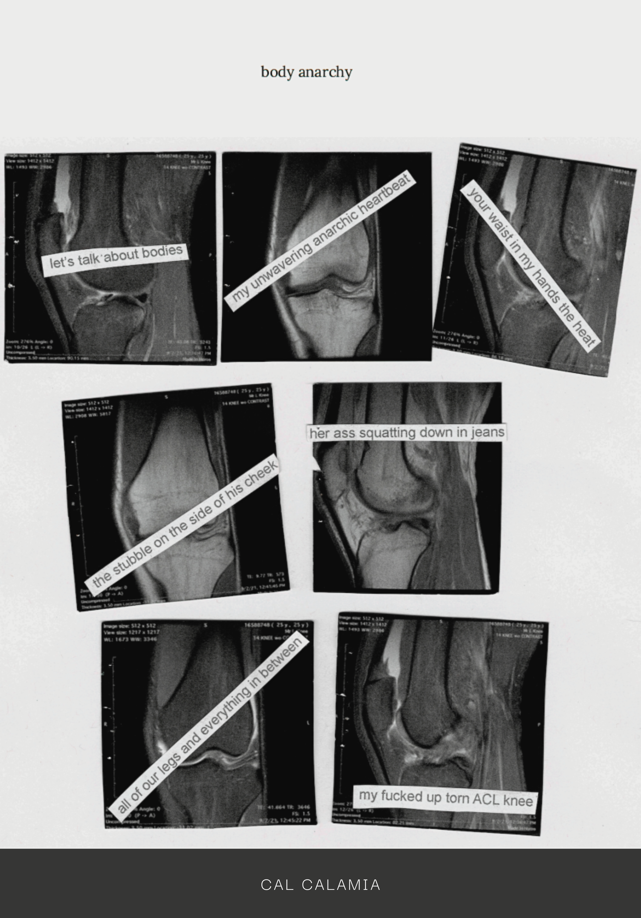 Cal Calamia | body anarchy