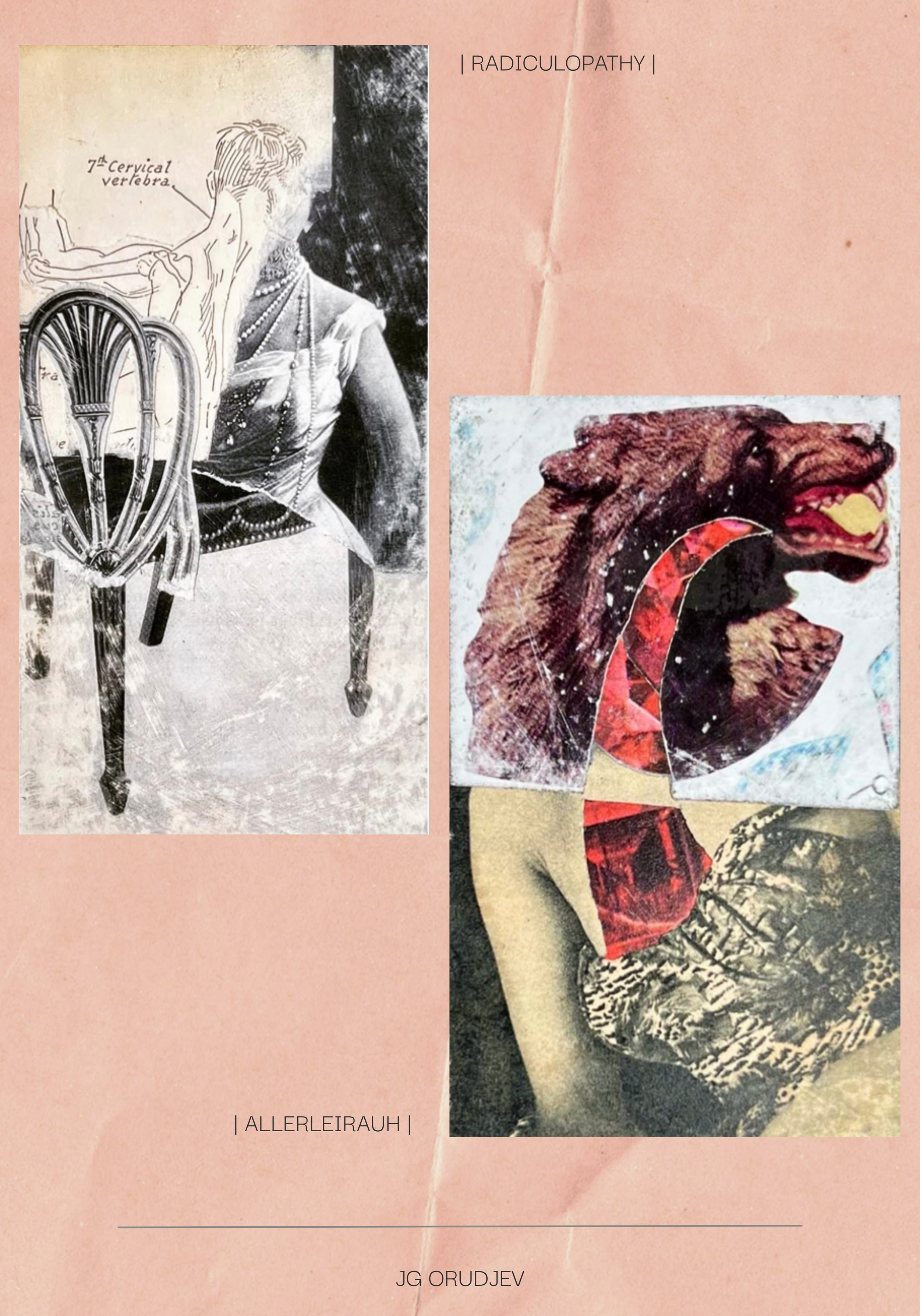 JG Orudjev | Radiculopathy and JG Orudjev | Allerleirauh