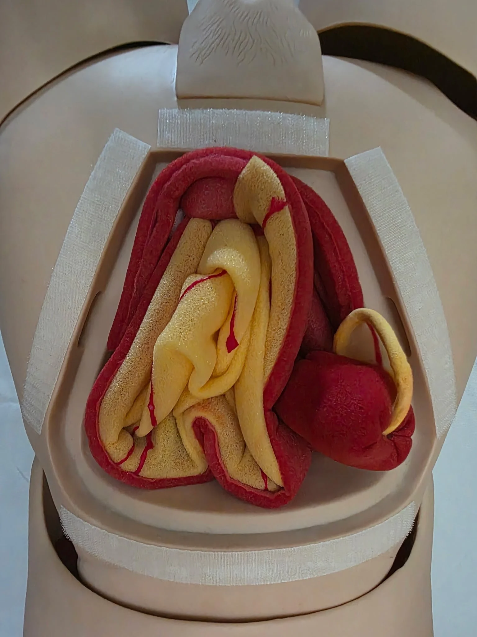 Abdominal and Reproductive Contents