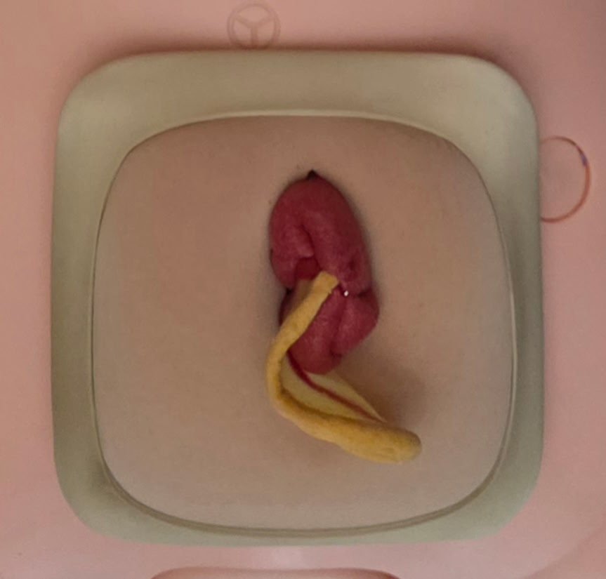Appendectomy Simulator Drop In
