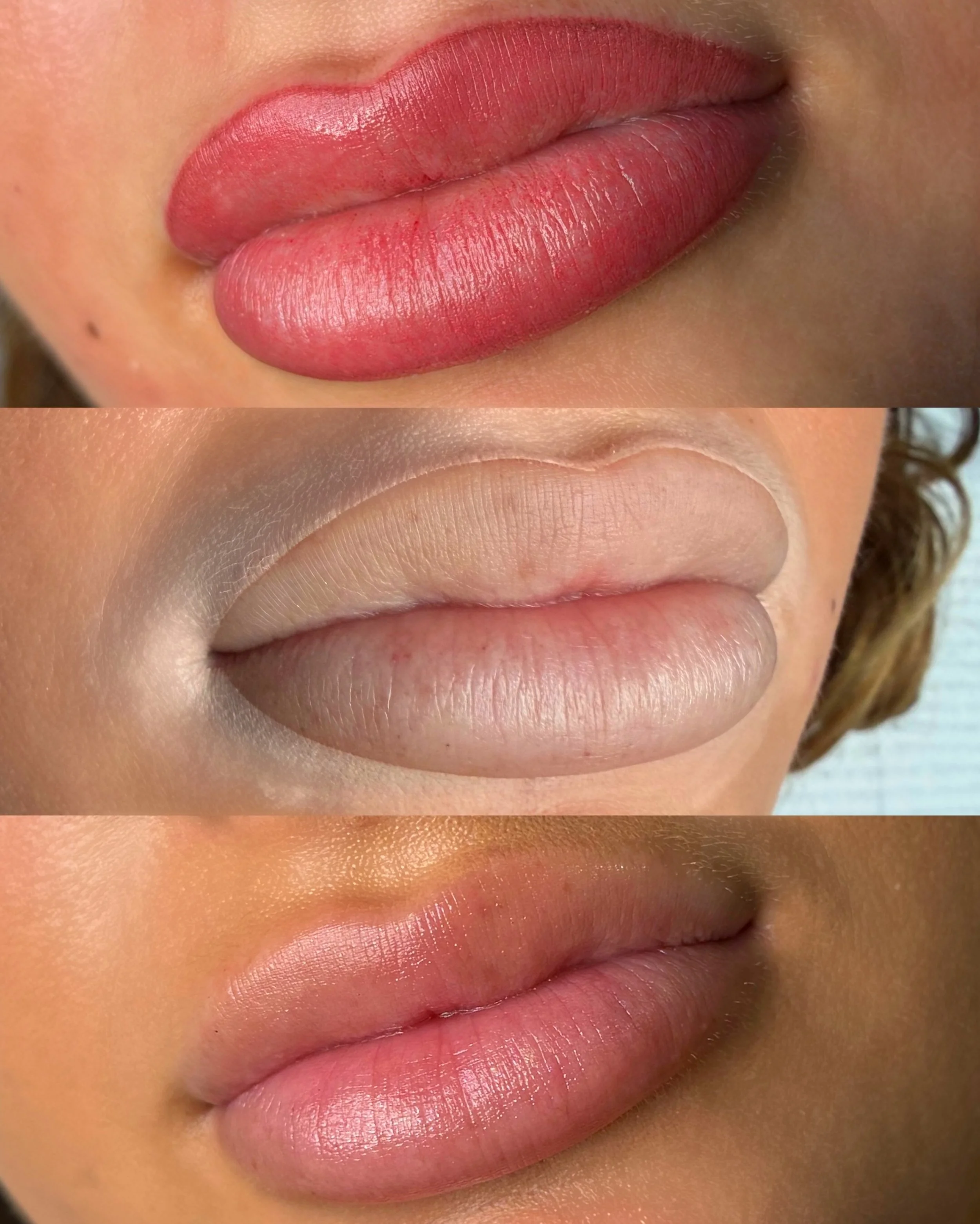 Got filler but still overlining your lips every day? 👀

Lip filler gives you volume&hellip; but it doesn&rsquo;t always give you colour.

In fact, as the lip skin stretches, lips can actually start looking paler and less defined without makeup.

Tha