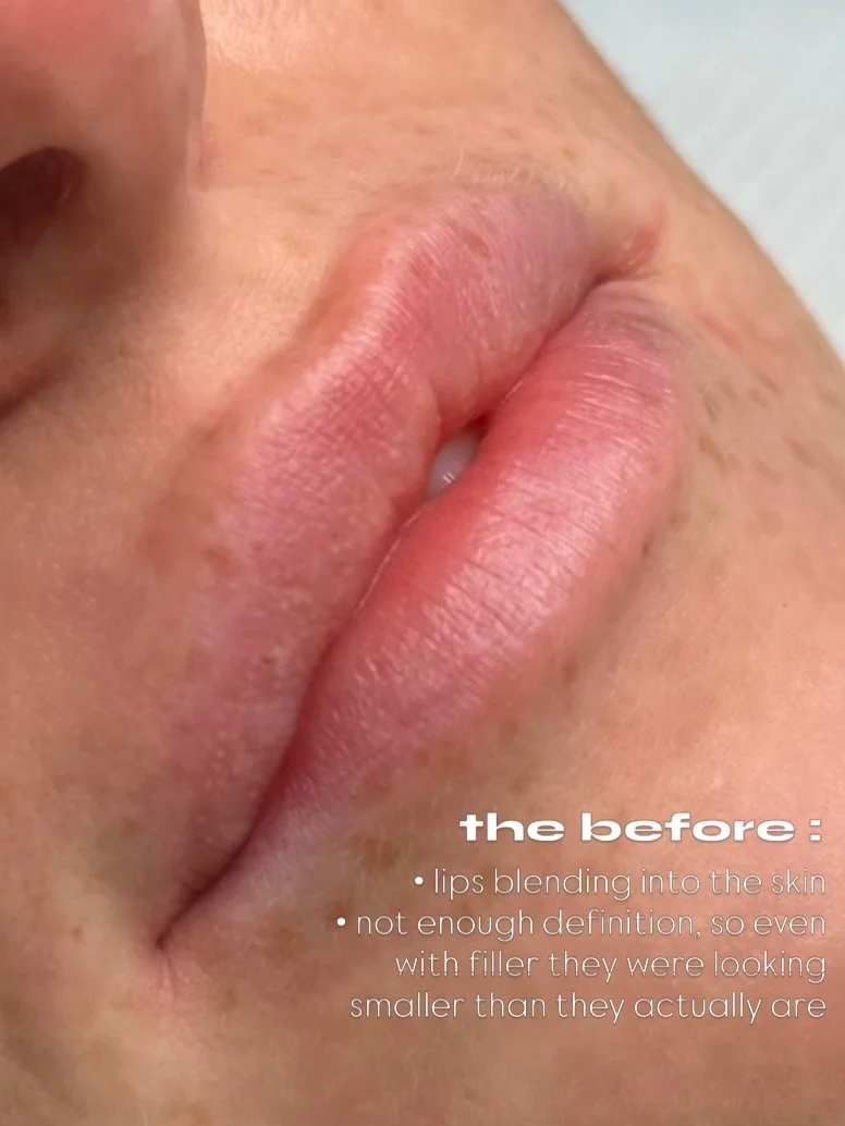 Proof that filler + lip blush do very different jobs 👀

The volume was already there, but without much colour or definition around the edges, her lips were still getting a little lost

Basically&hellip; her lips, just with the definition turned back