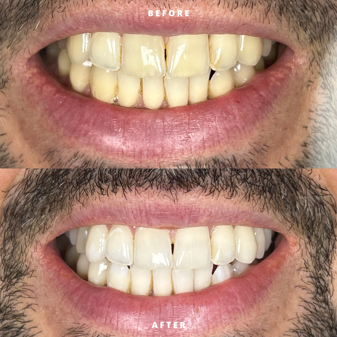 NEW BEFORE AND AFTER  (9).png