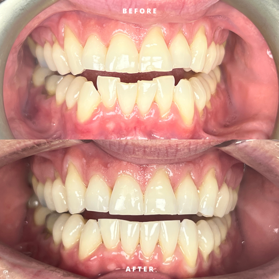 NEW BEFORE AND AFTER  (6).png