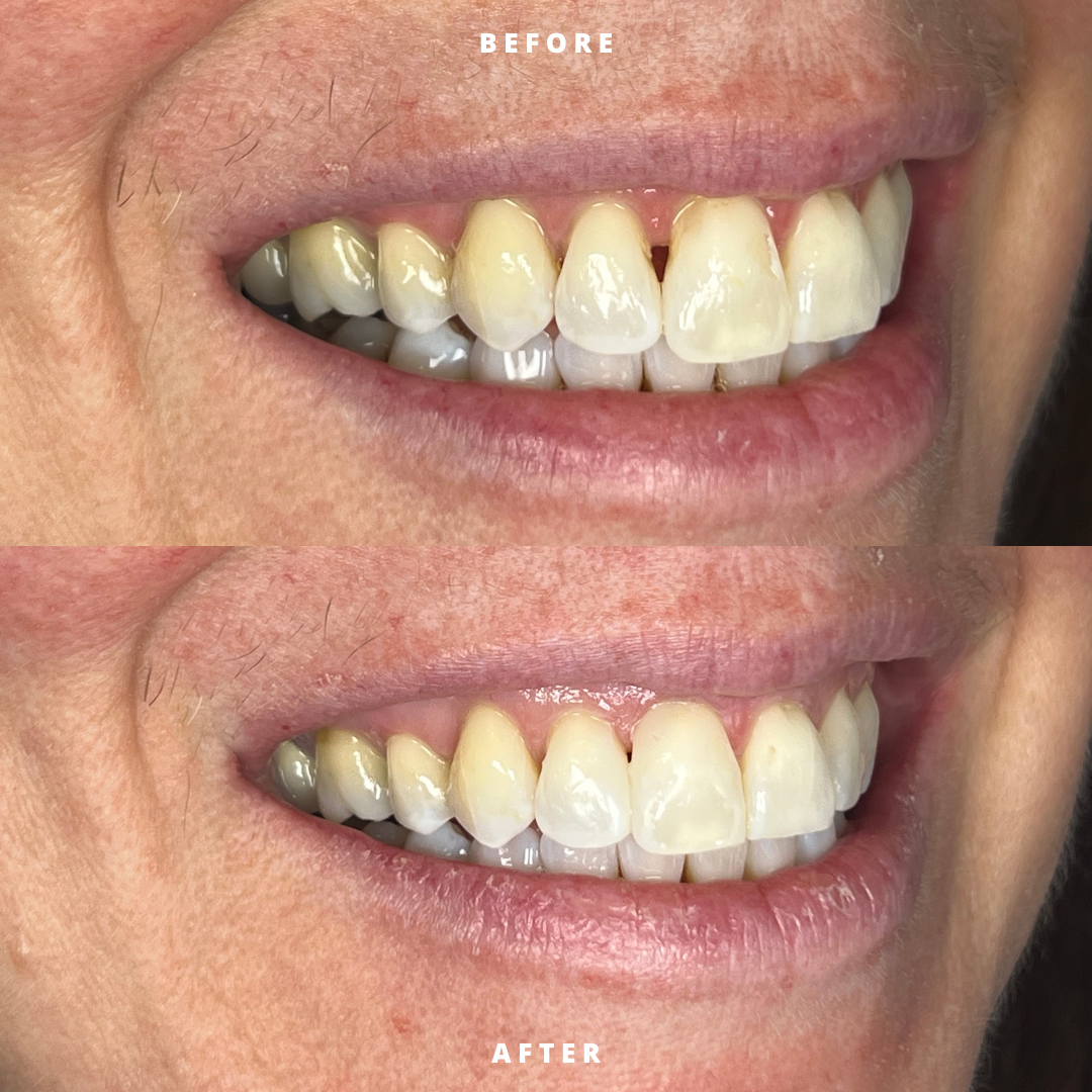 NEW BEFORE AND AFTER  (21).png