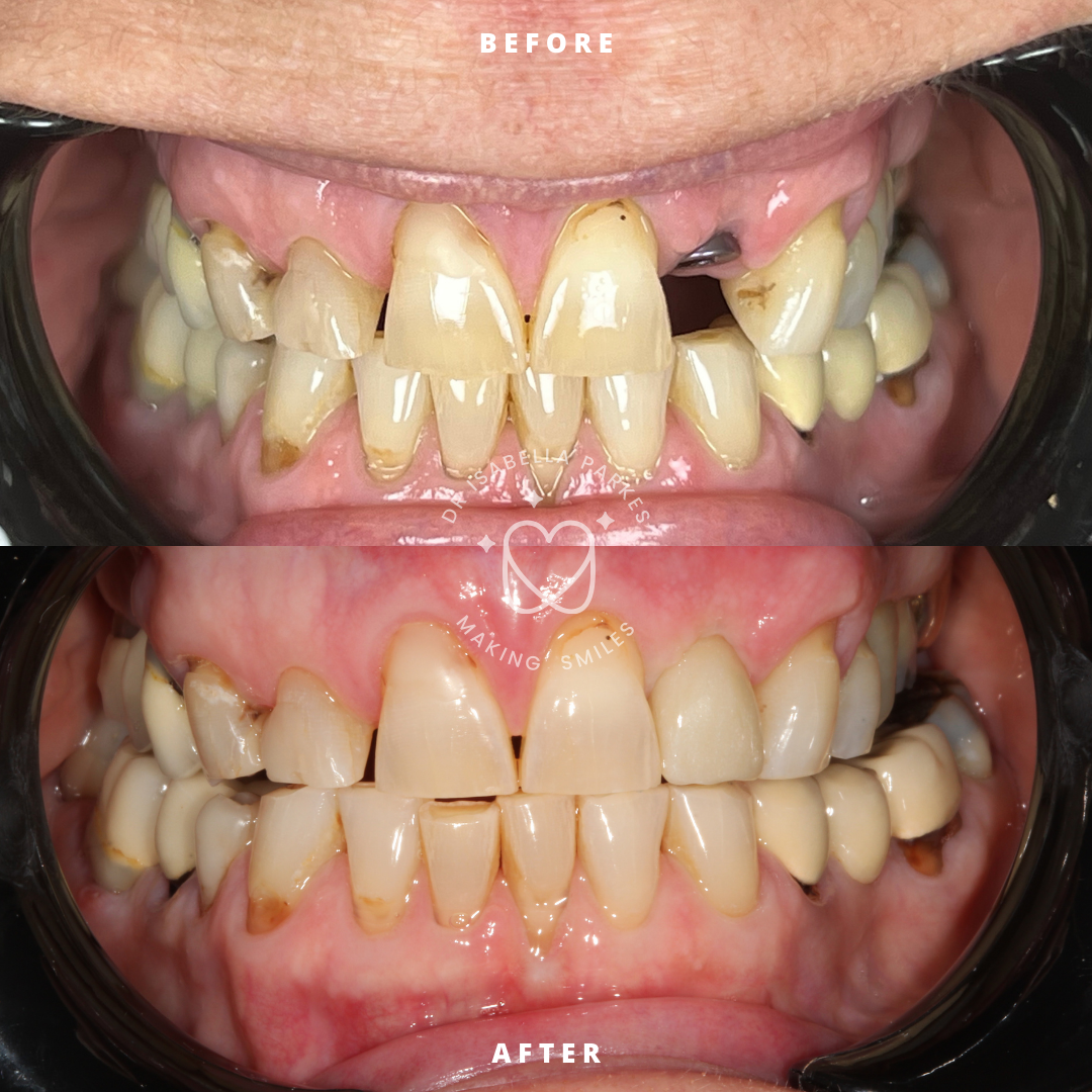 NEW BEFORE AND AFTER  (16).png