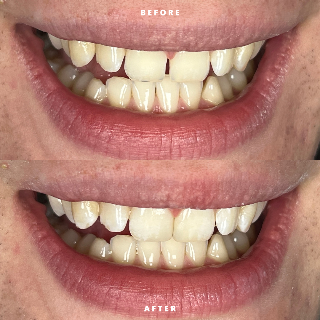 NEW BEFORE AND AFTER  (8).png