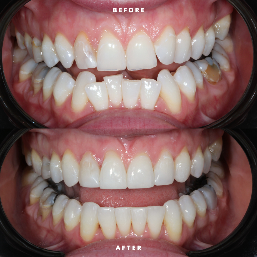 Copy of NEW BEFORE AND AFTER  (15).png