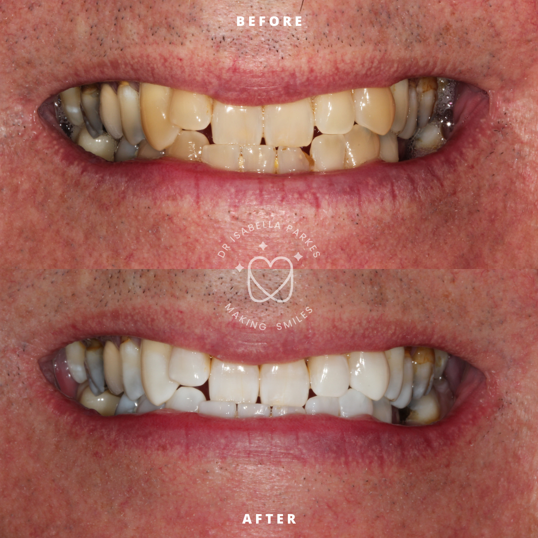 NEW BEFORE AND AFTER  (18).png