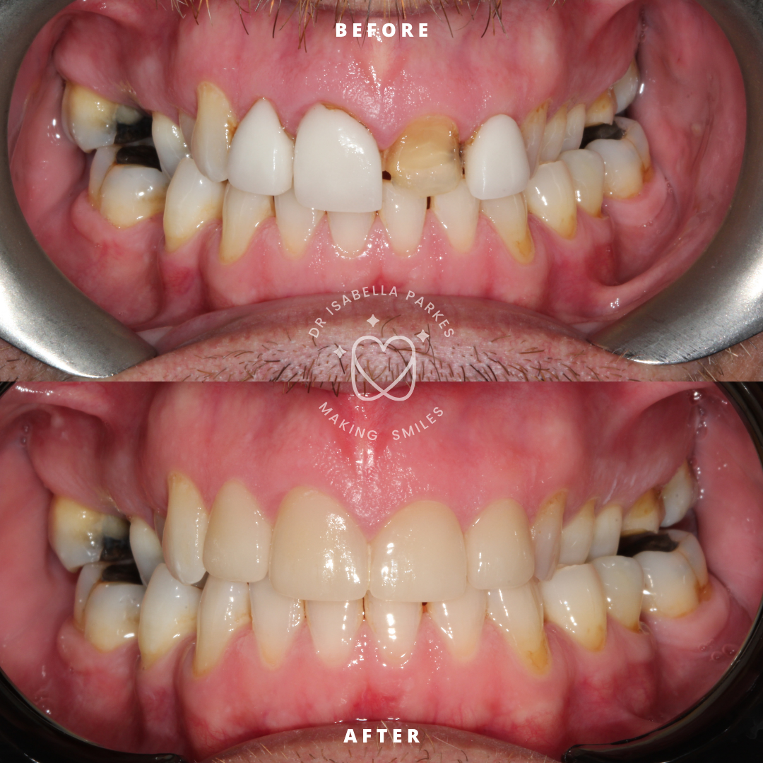 NEW BEFORE AND AFTER  (26).png