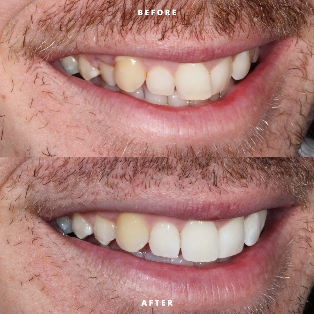 Copy of NEW BEFORE AND AFTER  (10).png