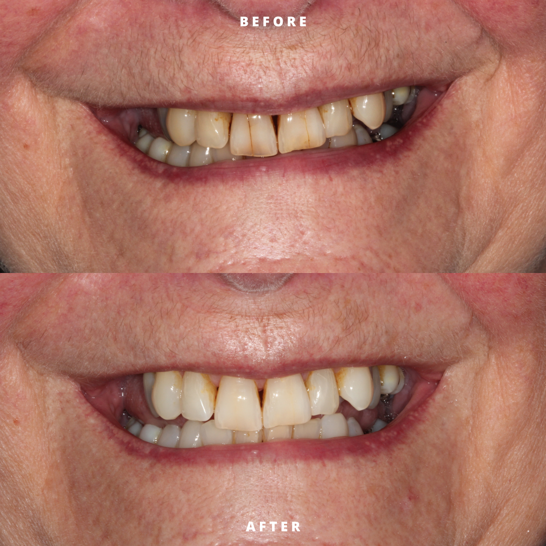 NEW BEFORE AND AFTER  (15).png