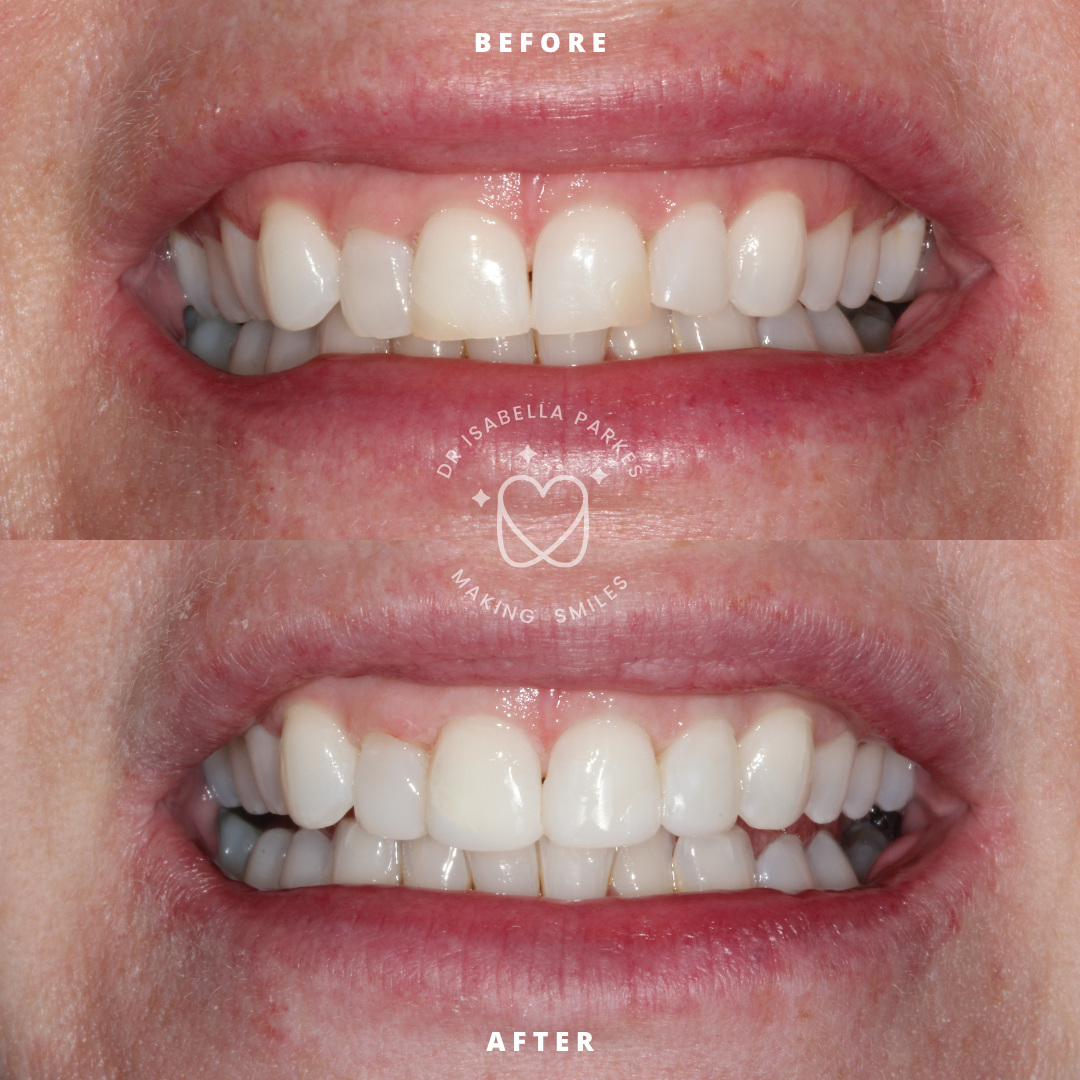 NEW BEFORE AND AFTER  (27).png