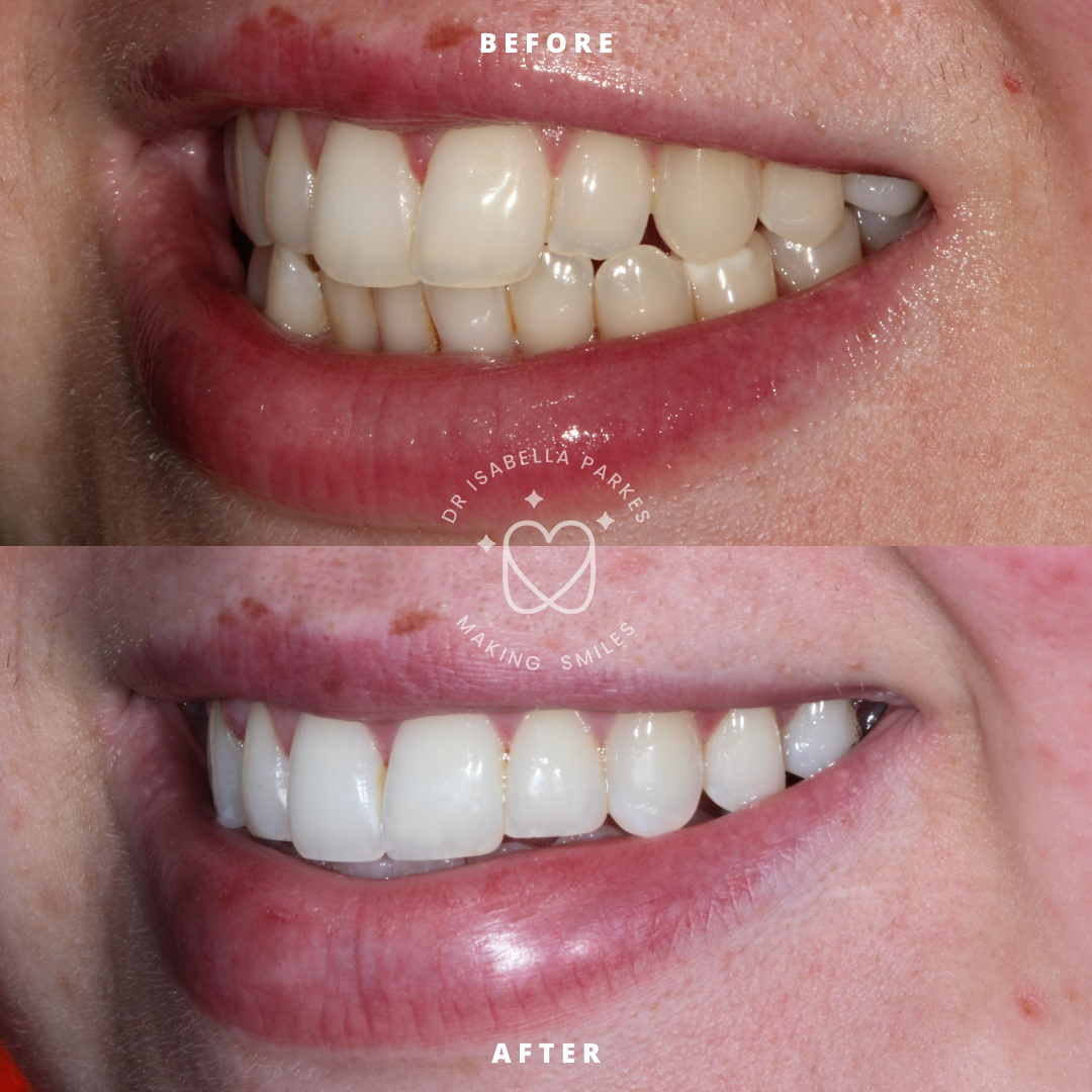 Copy of NEW BEFORE AND AFTER  (20).png