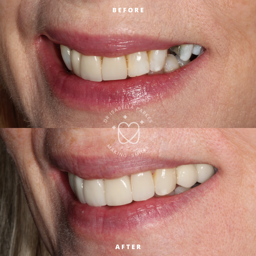 NEW BEFORE AND AFTER  (19).png