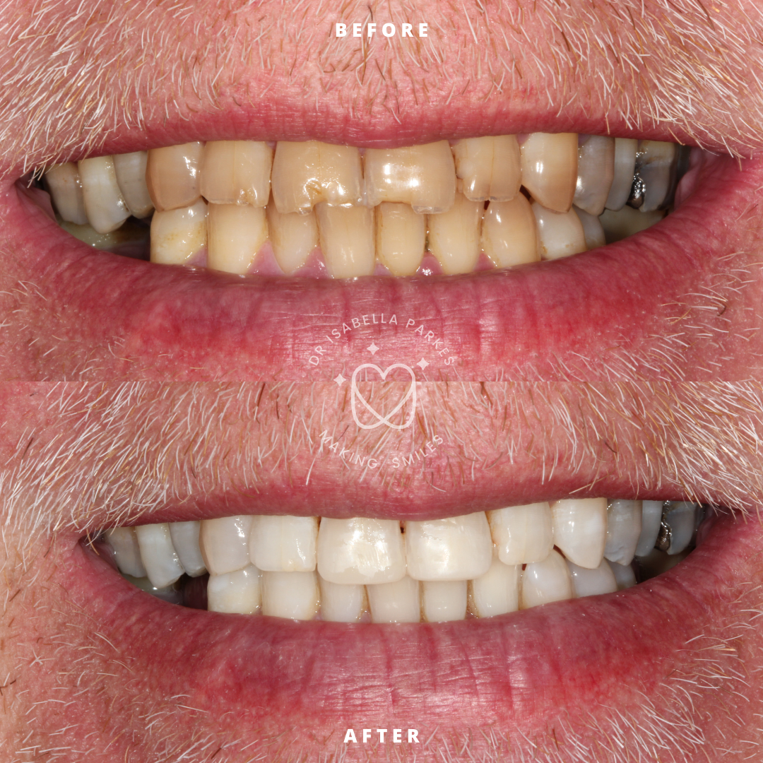 NEW BEFORE AND AFTER  (17).png