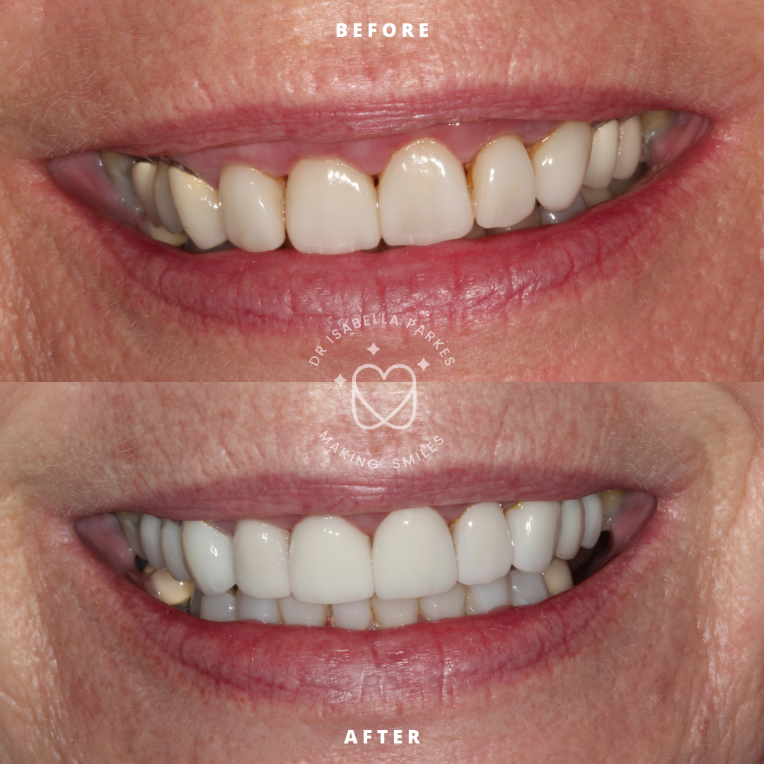 NEW BEFORE AND AFTER  (20).png