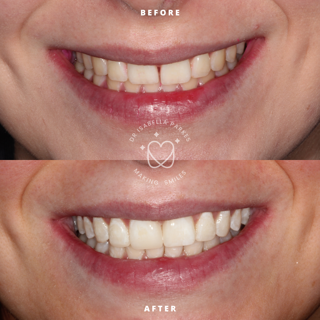 Copy of NEW BEFORE AND AFTER  (2).png