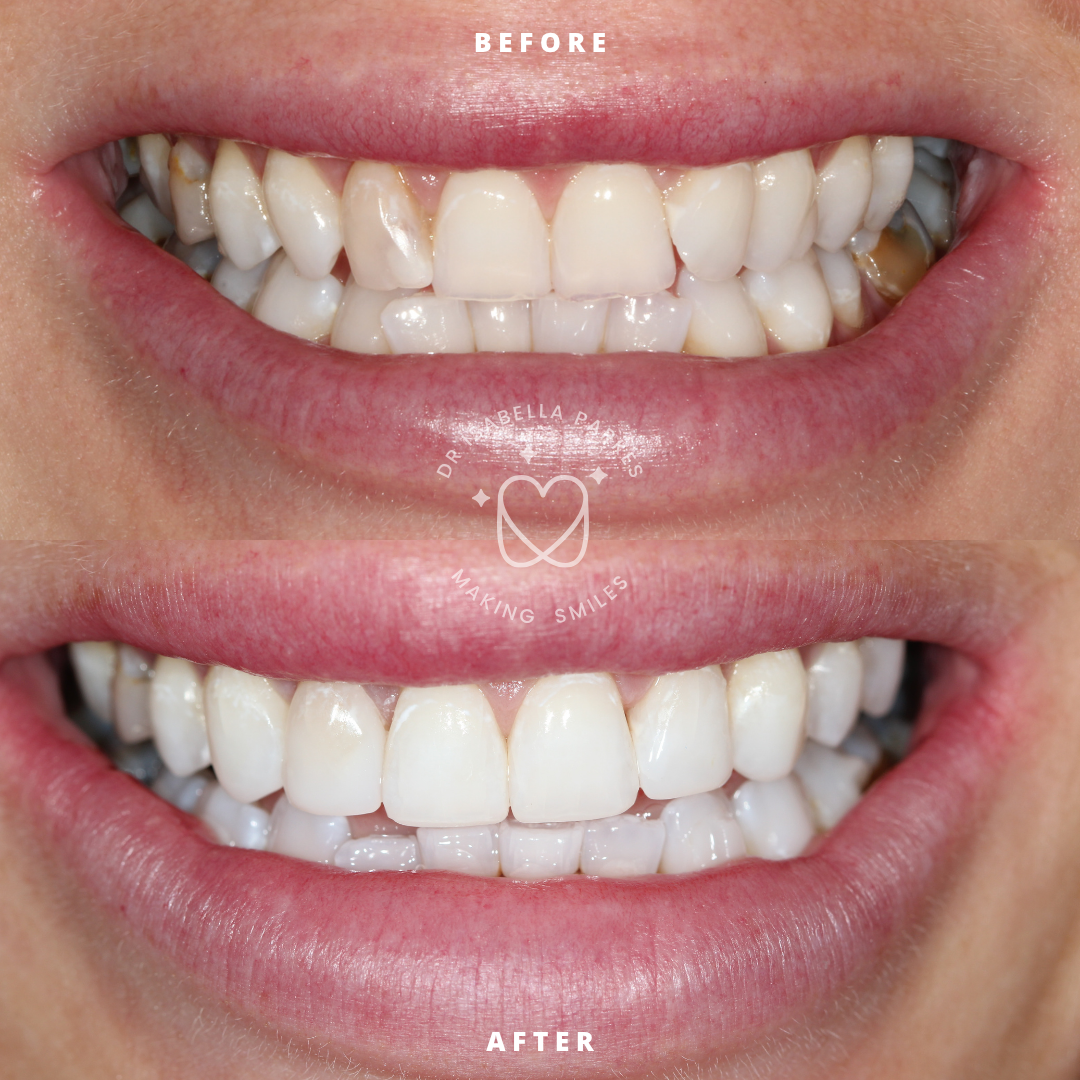 NEW BEFORE AND AFTER  (29).png