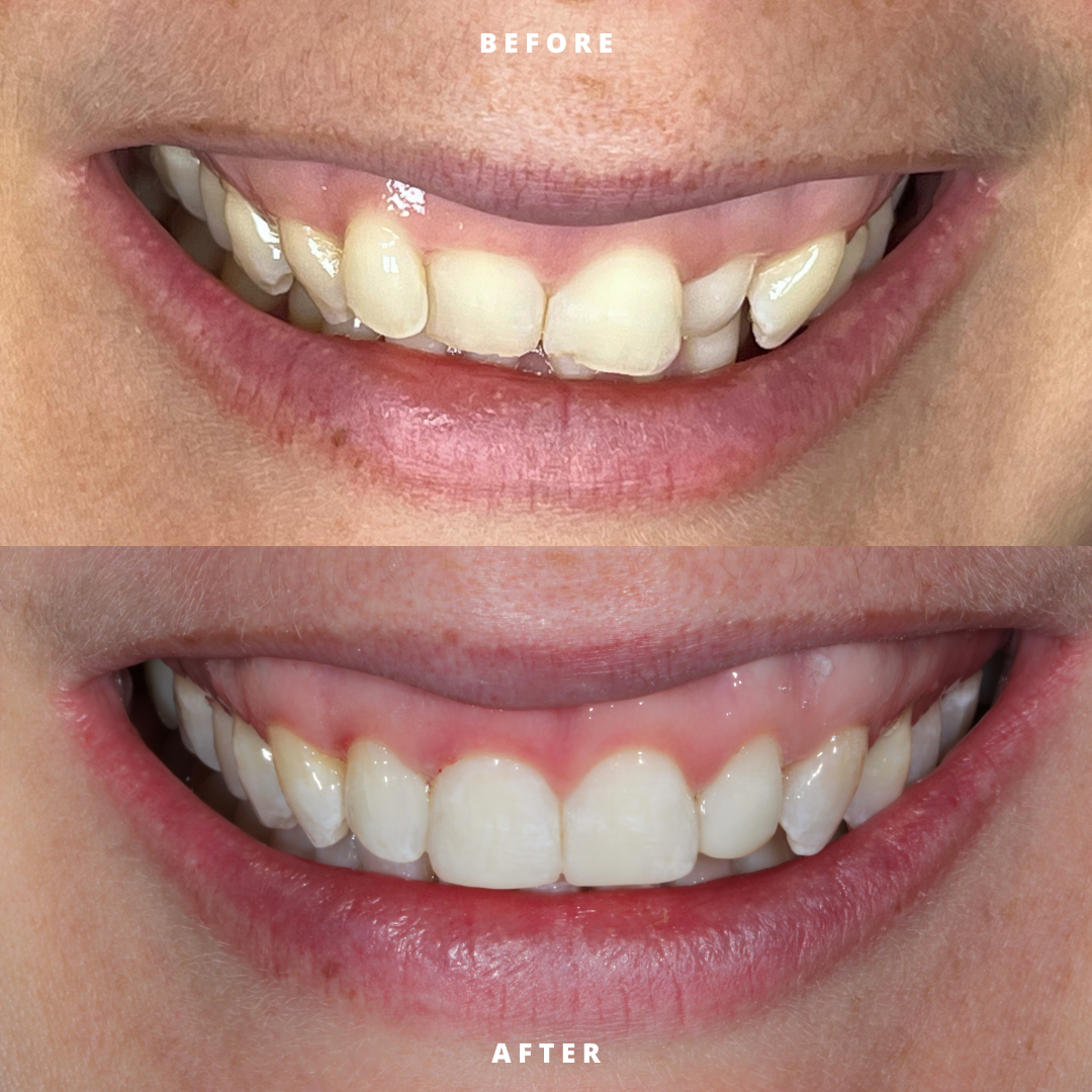 Copy of NEW BEFORE AND AFTER  (9).png