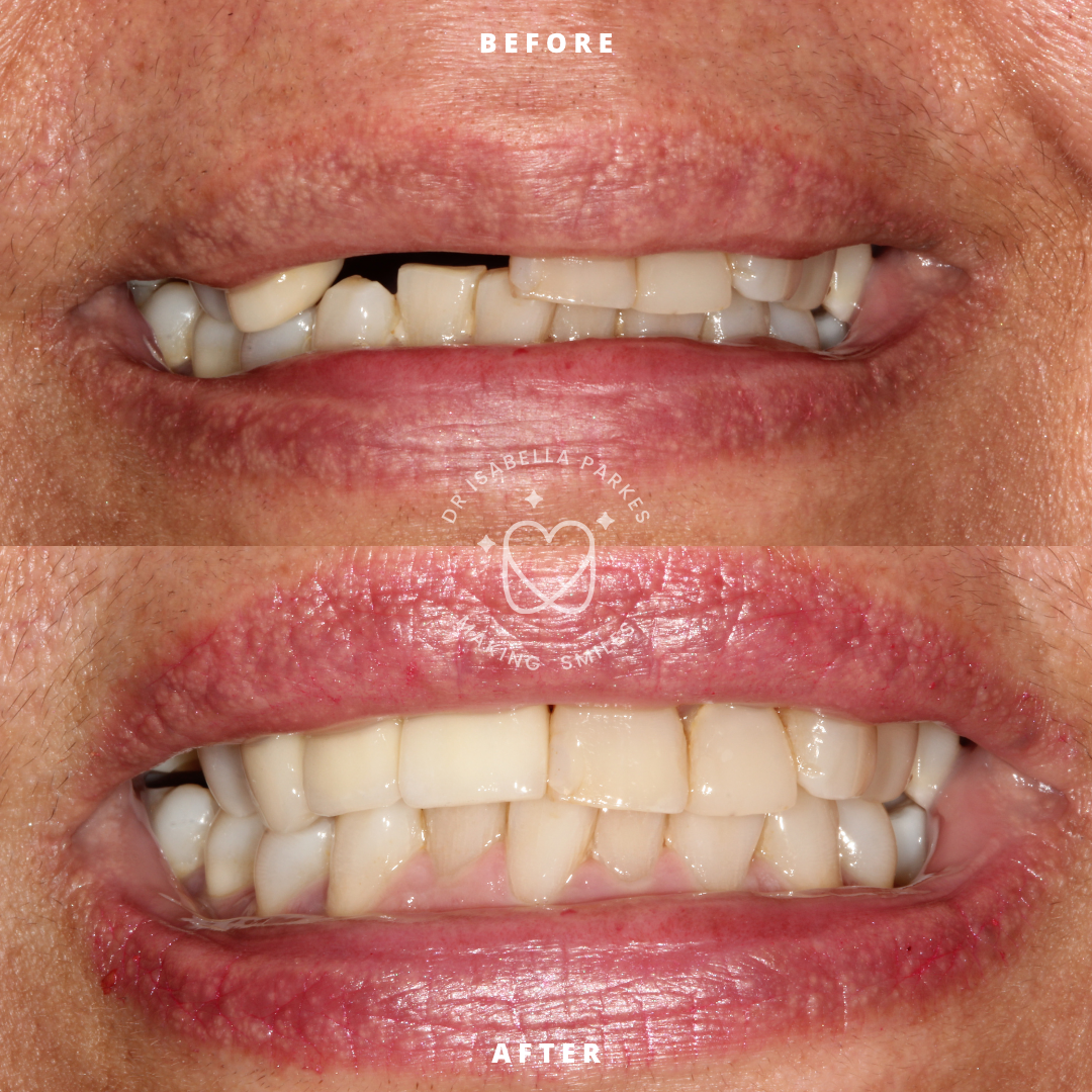 Copy of NEW BEFORE AND AFTER  (3).png