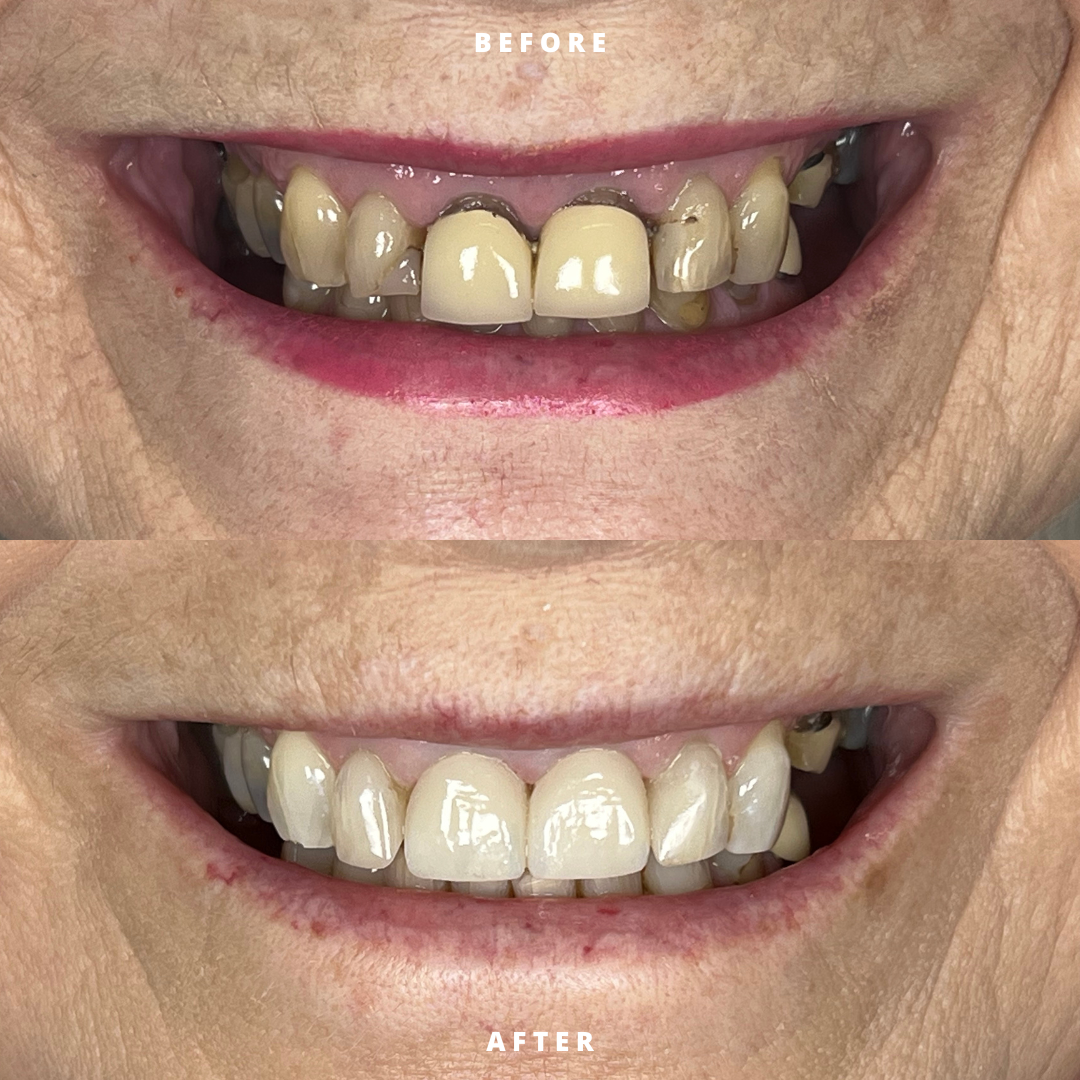 NEW BEFORE AND AFTER  (5).png