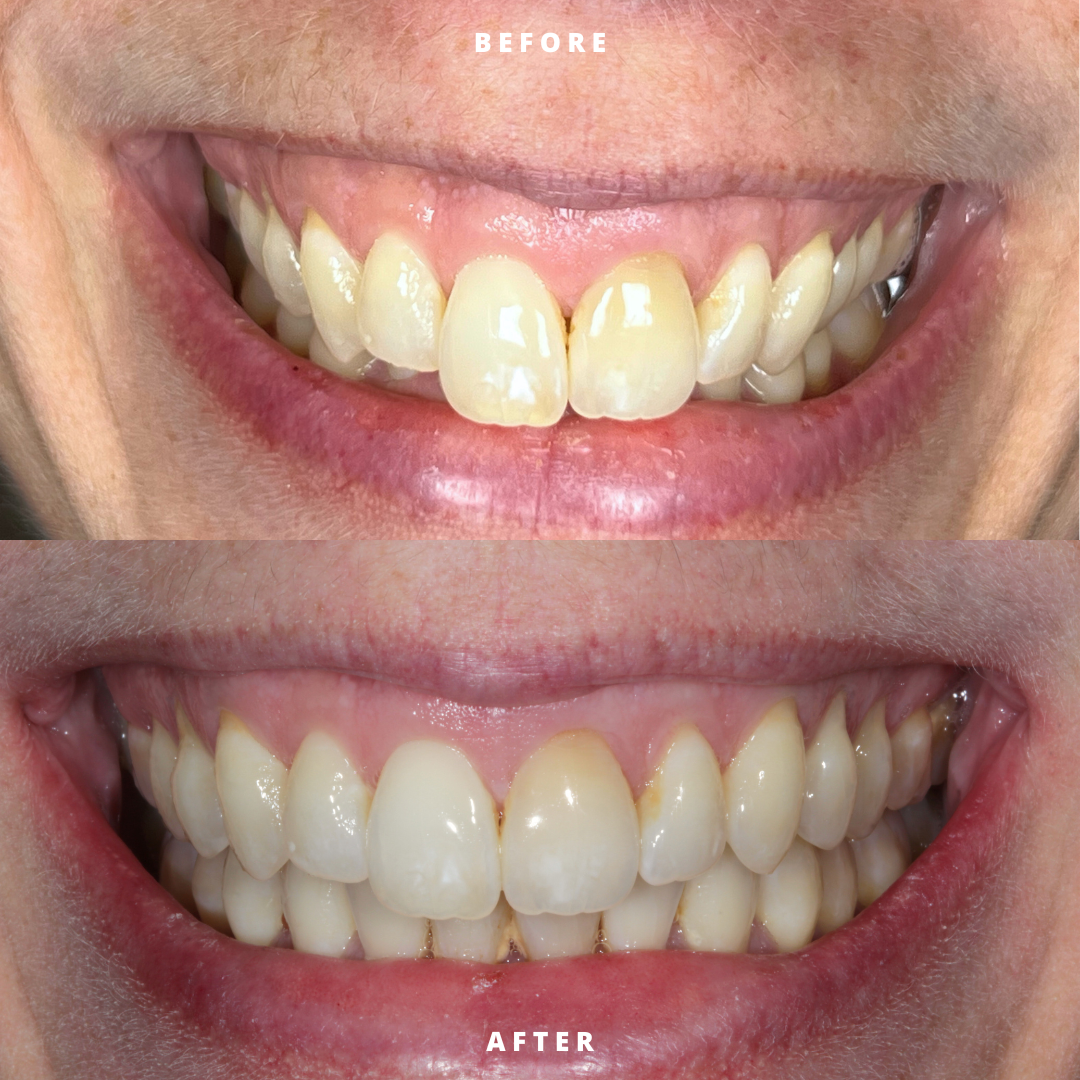 Copy of NEW BEFORE AND AFTER  (13).png