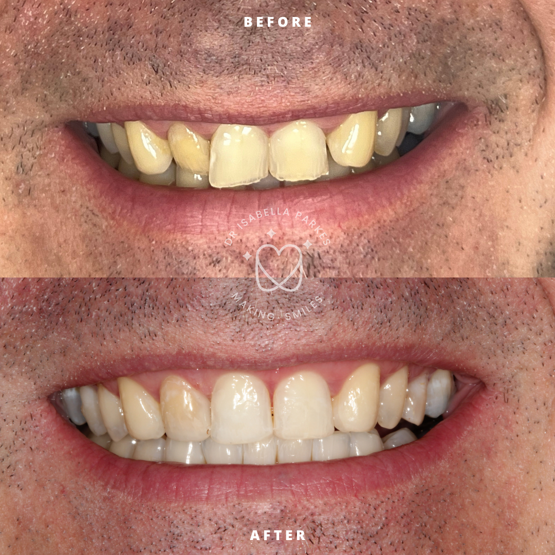 NEW BEFORE AND AFTER  (25).png