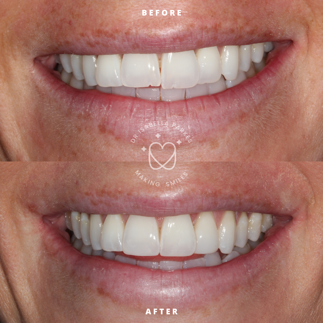 NEW BEFORE AND AFTER  (31).png