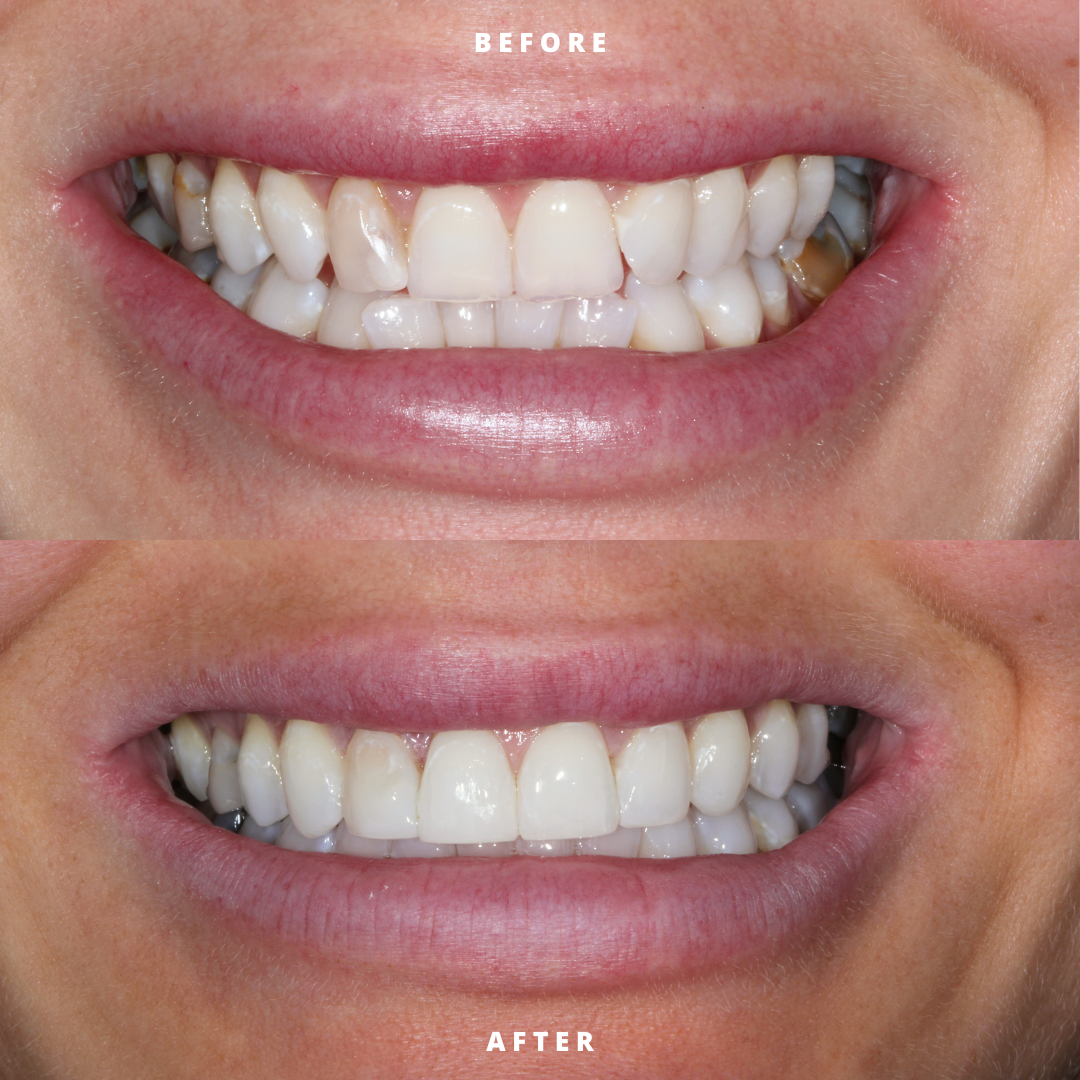 Copy of NEW BEFORE AND AFTER  (14).png