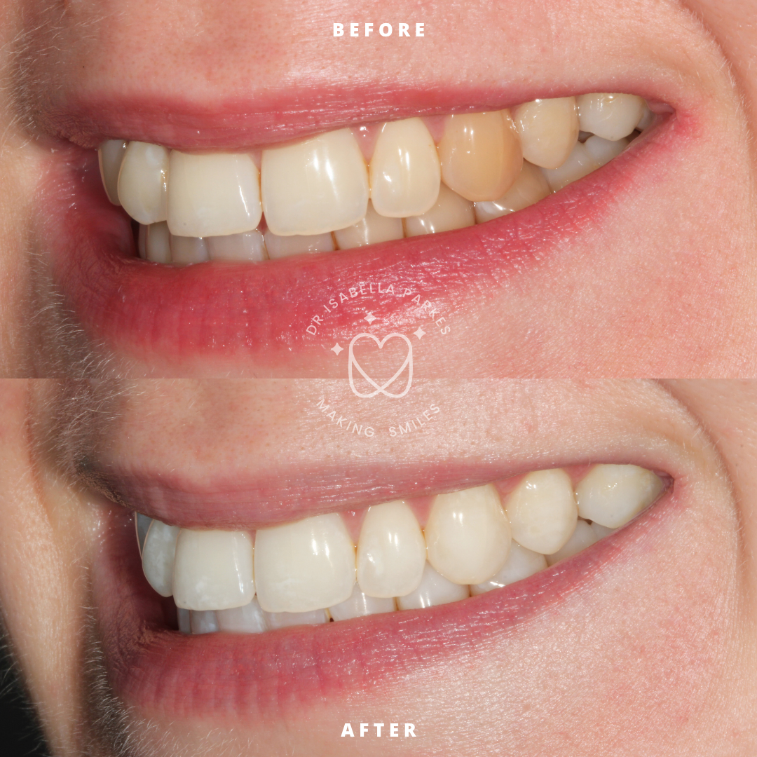 Copy of NEW BEFORE AND AFTER  (1).png