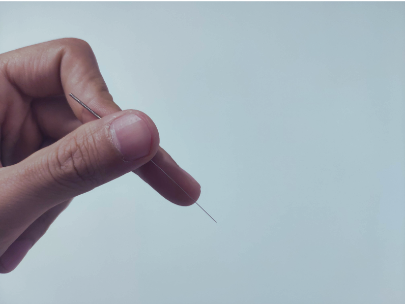 Dry Needling and Acupuncture: What’s the Difference? - Warrnambool
