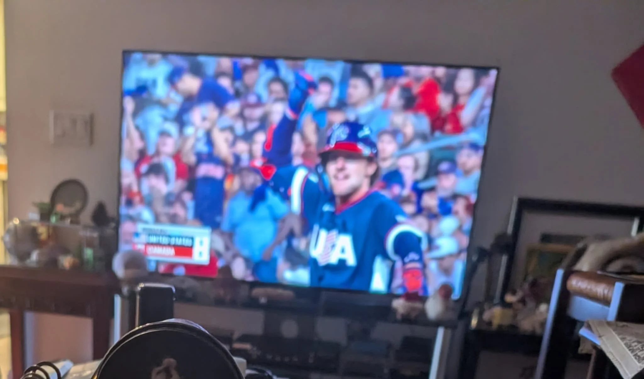 Ronald Acuña Jr’s armband