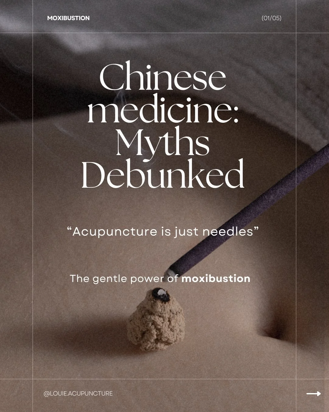I love debunking common myths about acupuncture, and this has got to be my favourite one. 

Many people only think of needles when they think of acupuncture (which is fair tbh!) but acupuncture involves all sorts of tools.

Gua Sha, cupping, massage,