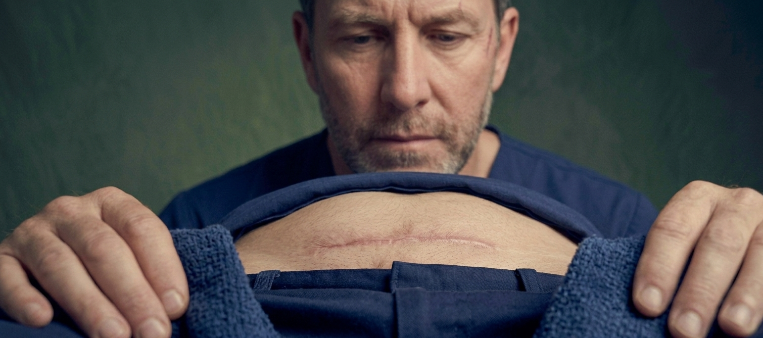 Buried penis reconstruction surgery to restore functional anatomy in Dubai