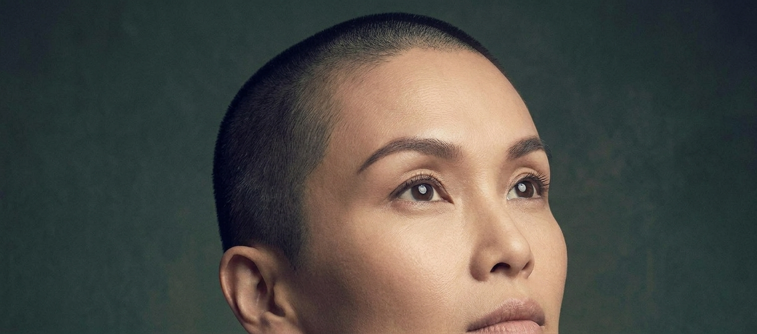 Brow lift surgery to elevate and refresh the forehead area in Dubai