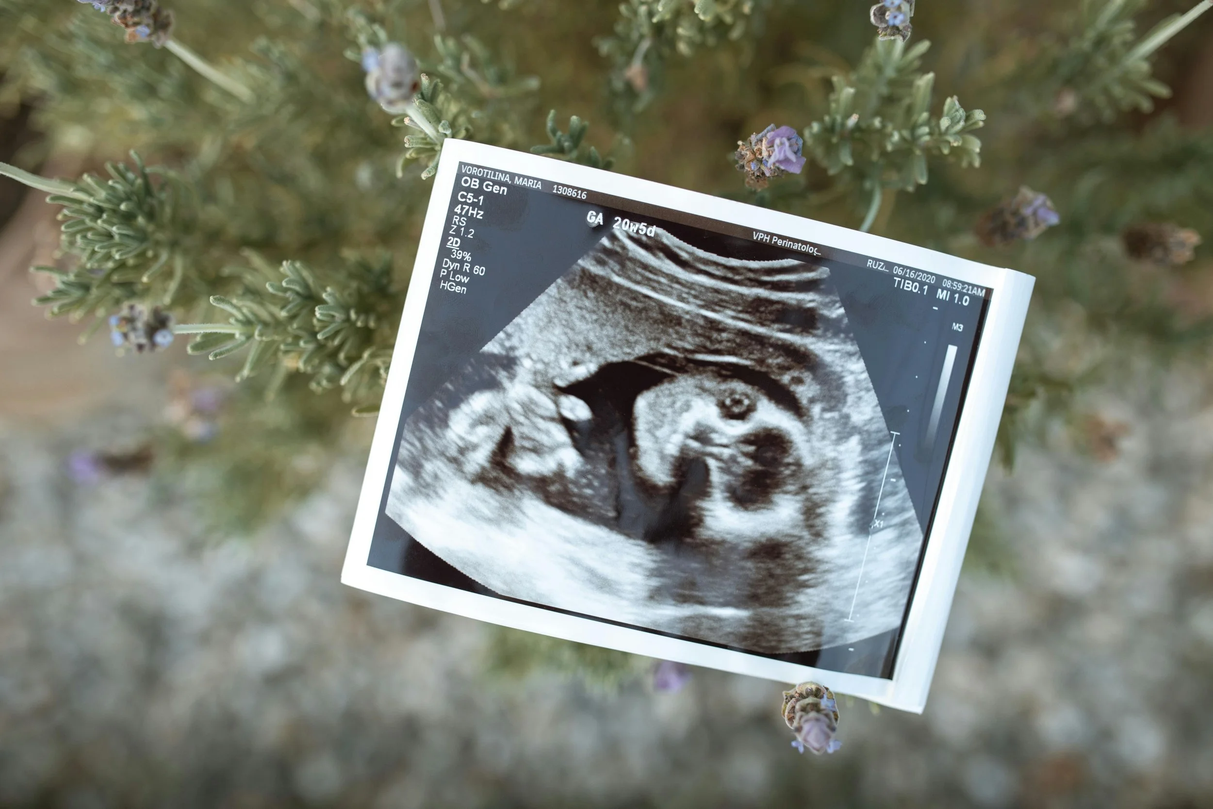 Ultrasound image of a fetus on a background of plants with purple flowers.