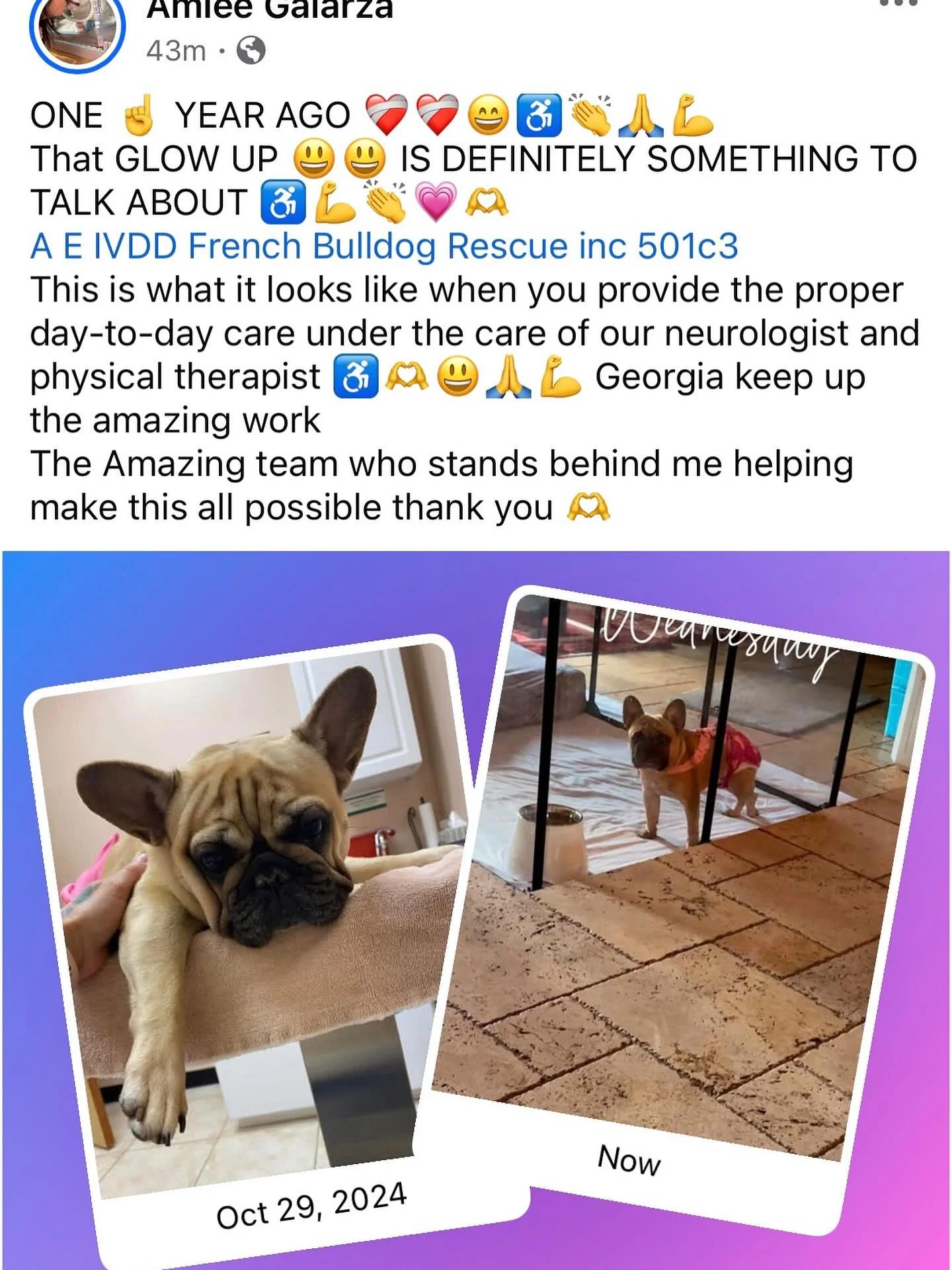 That glow up is serious. Definitely something to talk about from then to now this lifestyle is far from easy and not for everyone, but it’s for me. You have to be willing to put in the hard work physical therapy along with therapy. You have to