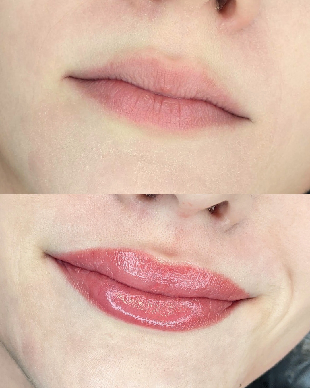 Lips Before After 1006gyu.png