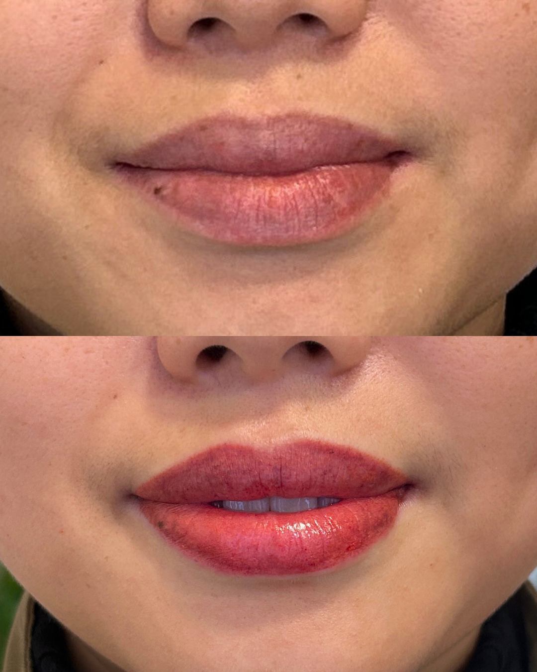 Lips Before After 1006 (2).png