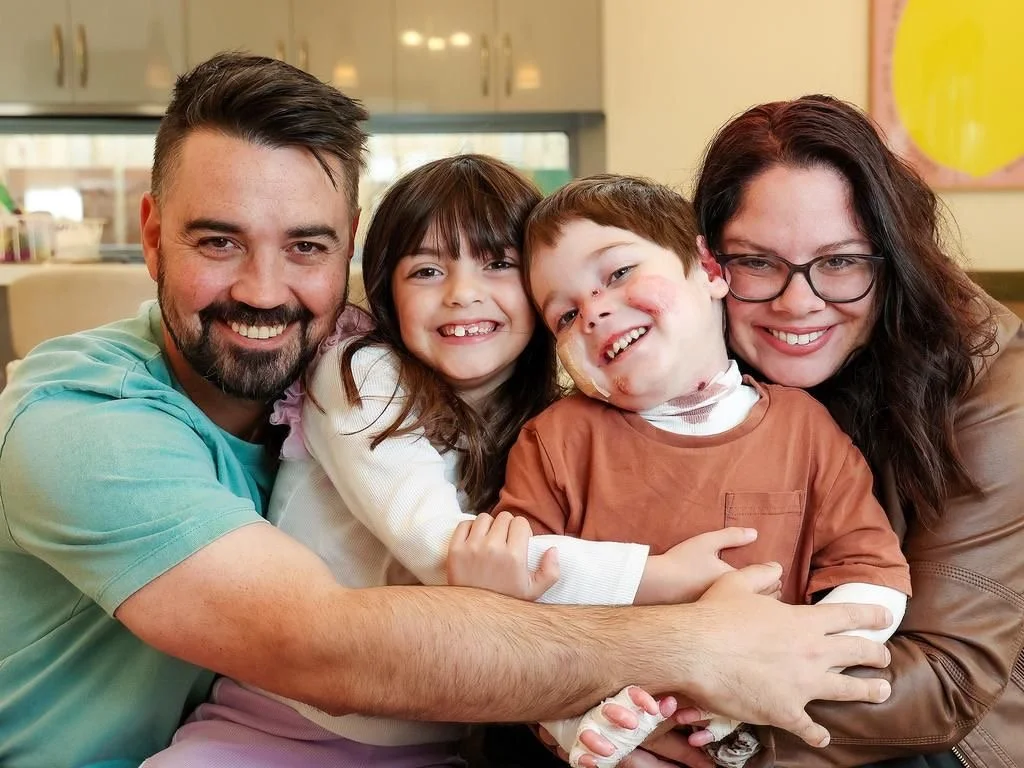 4 year old Jacob Burmeister who lives with EB and his family.