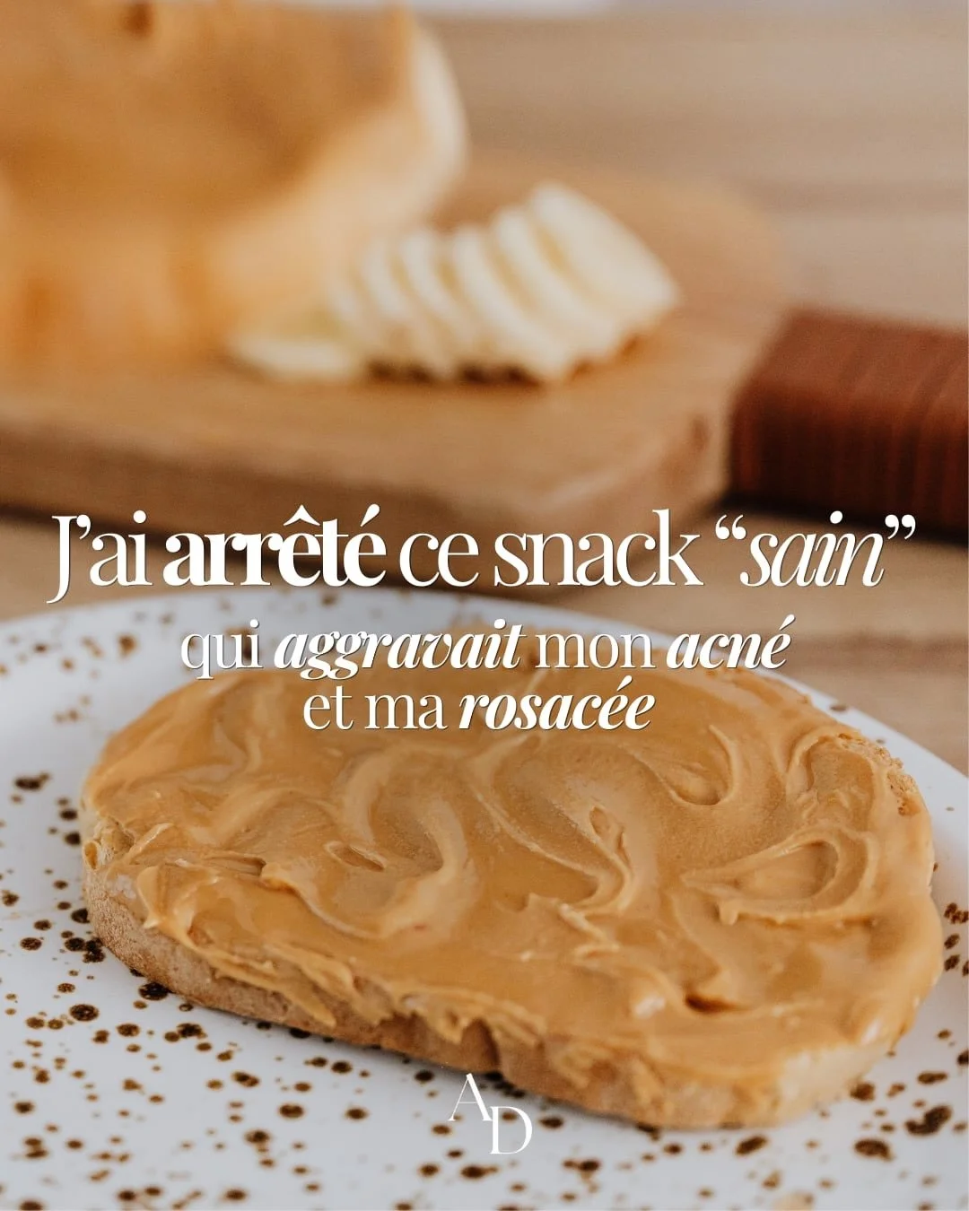 On le retrouve partout dans les routines &laquo;&nbsp;healthy&nbsp;&raquo;&hellip; pourtant il peut entretenir certains terrains inflammatoires. 

#acneadulte #rosac&eacute;e #inflammationchronique #beurredecacahuete #bellepeau