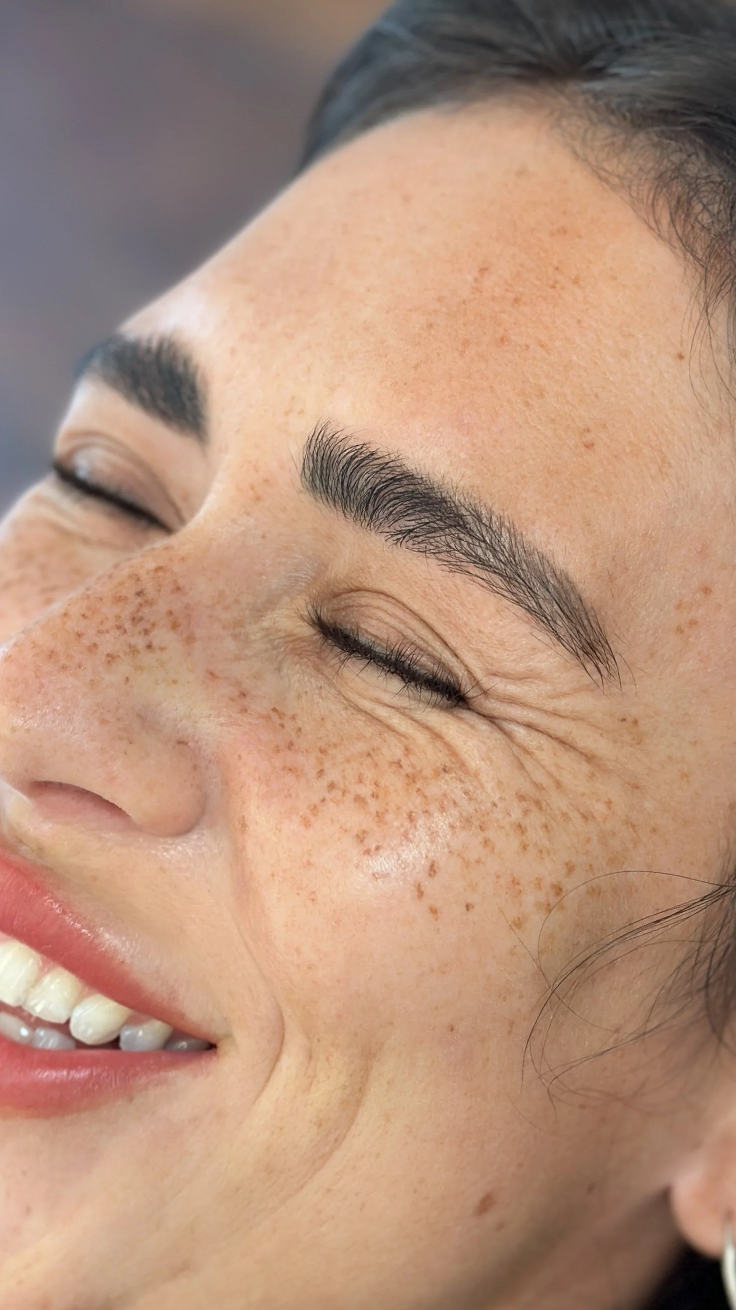 healed faux freckles; full coverage