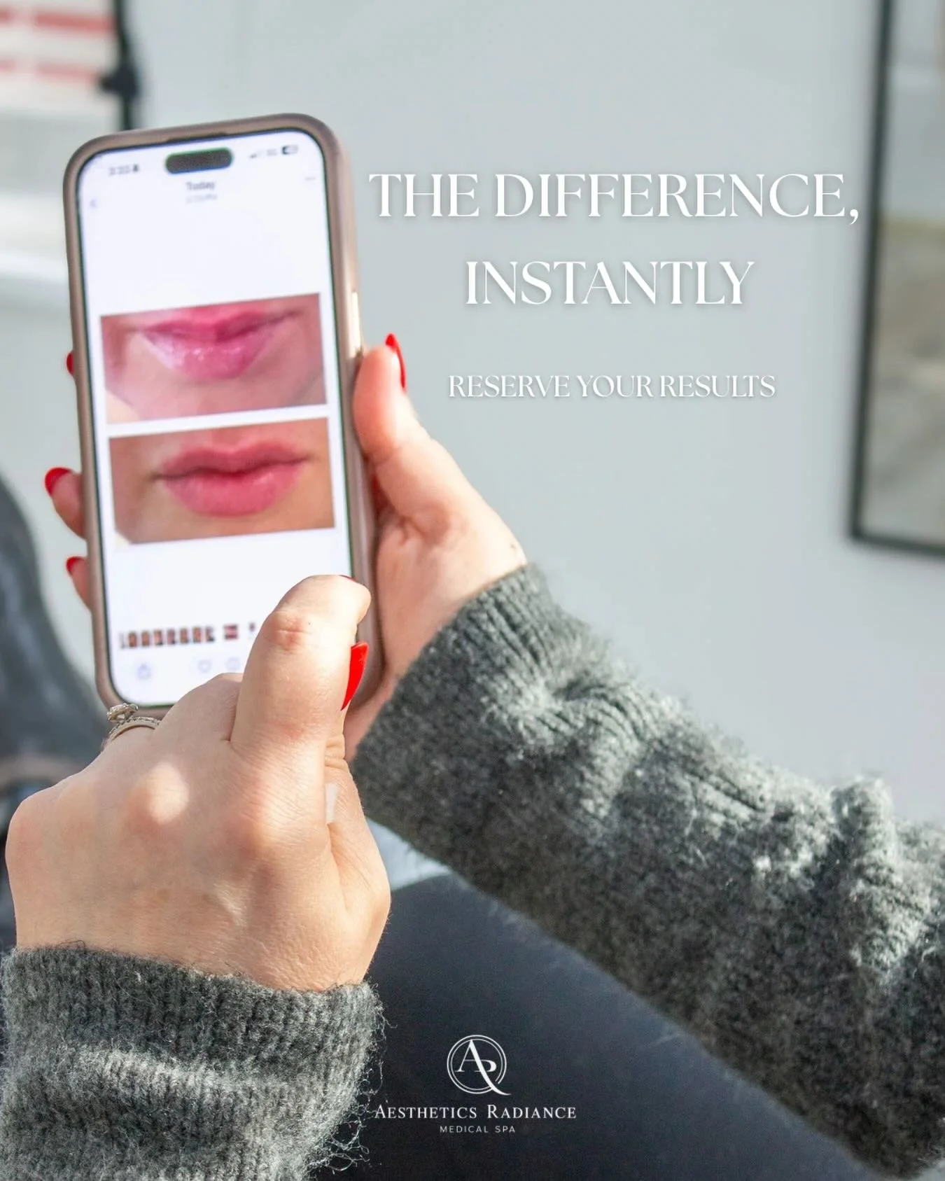 Real results, captured in real time ✨

Your glow-up starts here.
Book your appointment today &mdash; 724-504-1381

#marspa #cranberrypa #pittsburghpa #pittsburghmedspa #pittsburghinjector