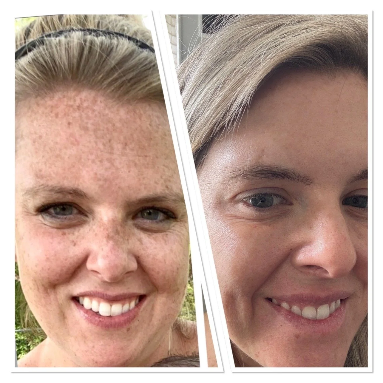 Hi everyone! This is Danielle, PA-C and owner of Aesthetics Radiance Medical Spa. 
I always love to share parts of my WHY in every aspect of my life as I feel we all can help each other grow a little along the way. While this example is only a piece 