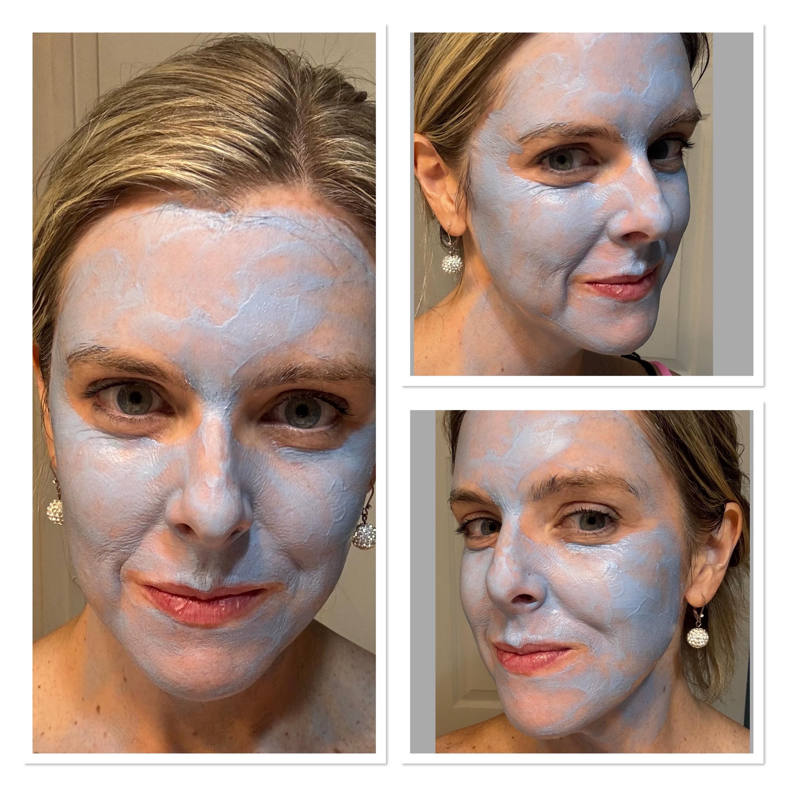 What&rsquo;s with the blue face? 

The ZO Skin Health Complexion Renewal Mask is a deep-cleaning, oil-balancing exfoliating treatment designed especially for acne-prone or congested skin.

Here&rsquo;s what it actually does for your skin:

This is a 