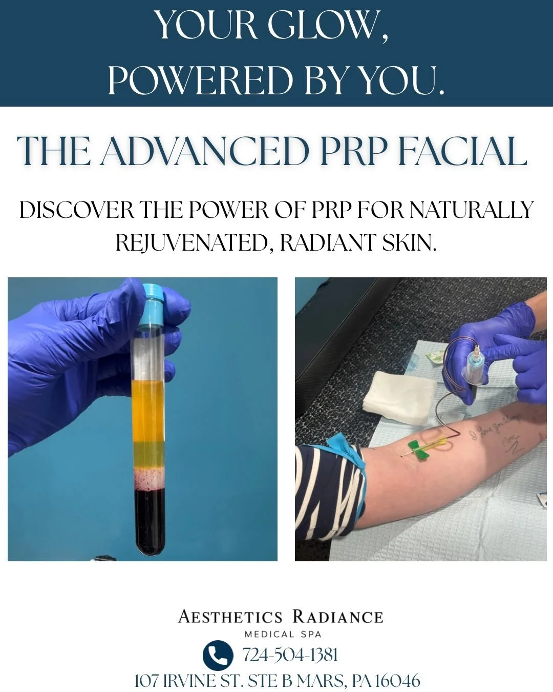 Collagen stimulation meets next-level recovery.

Our Advanced PRP Facial combines microneedling with your body&rsquo;s own platelet-rich plasma (PRP) to help improve skin texture, soften fine lines, refine pores, and restore a healthy, radiant glow.
