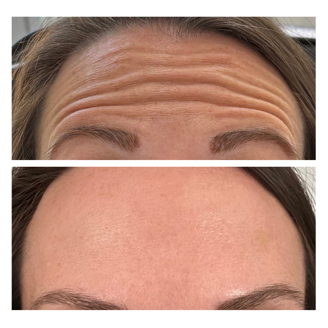 Medspa in Mars, PA 16046 l Aesthetics Radiance Medical Spa (5).png